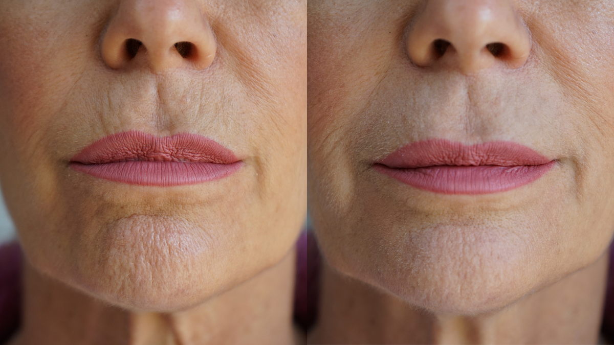 Ageless Lip & Line Filler PRAI — Efecto Filtro de Belleza | PRAI Lip & Line Filler