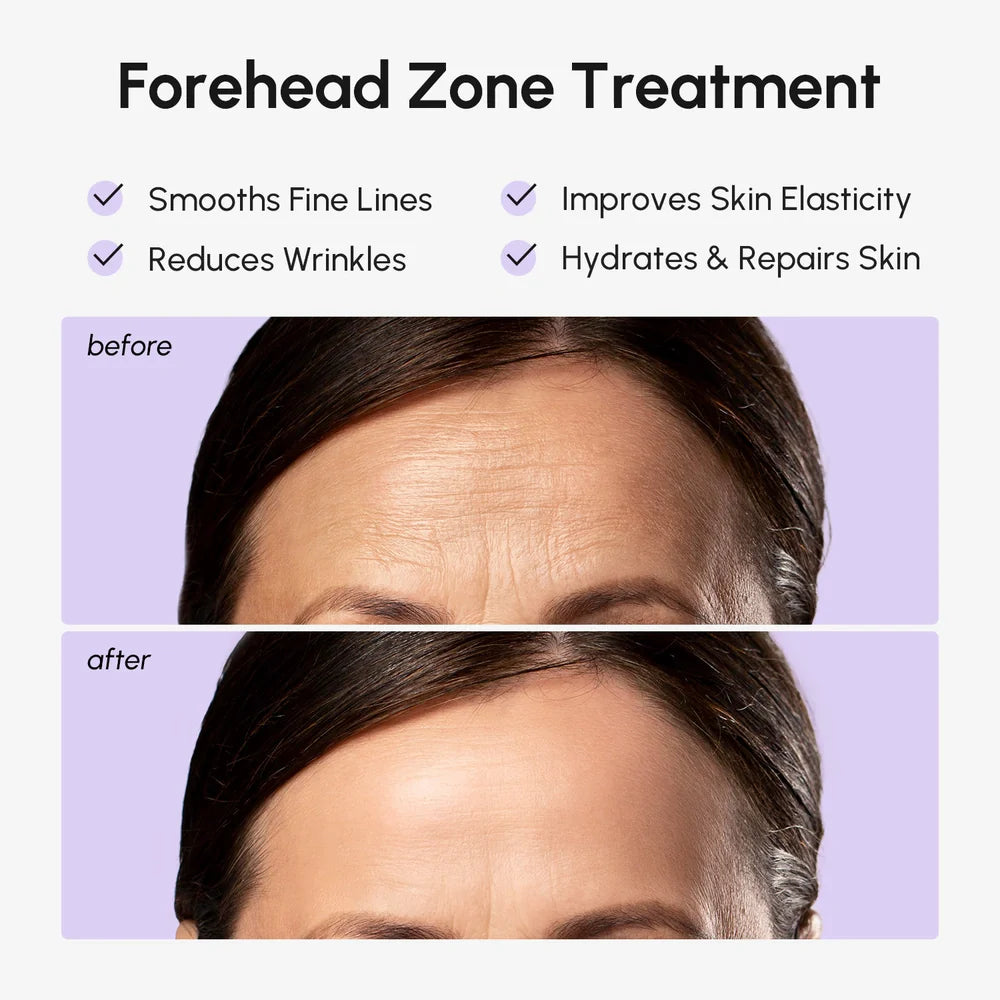 Parches Antirrugas para la Frente Marée — Hidrogel Antiedad | Anti-Wrinkle Forehead Patches